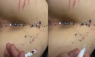 校园暴力